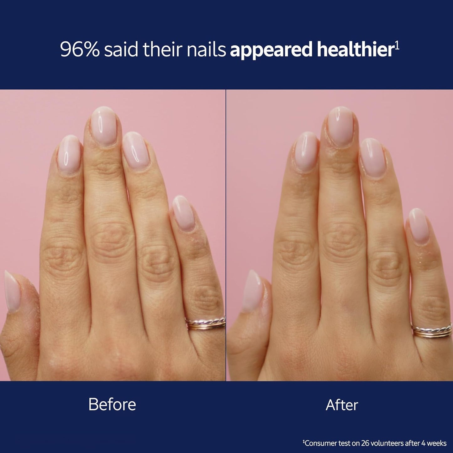 L'Occitane L'OCCITANE Shea Nourishing Nail & Cuticle Oil: With 30% Shea Oil, Healthier-Looking Nails, Soften Cuticles, Strengthen Nails, 0.25 Fl. Oz