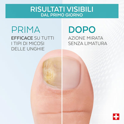 PODERM - NAIL MYCOSIS TREATMENT 2 in 1 - Herbal with extraordinary antifungal and repairing qualities - Professional hand/foot treatment - Quick and easy - Swiss Made