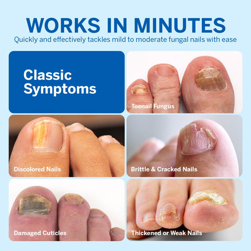 Toenail Fungus Treatment Extra Strength: Nail Fungus Treatment for Toenail - Fungal Nail Repair Pen 4 Packs