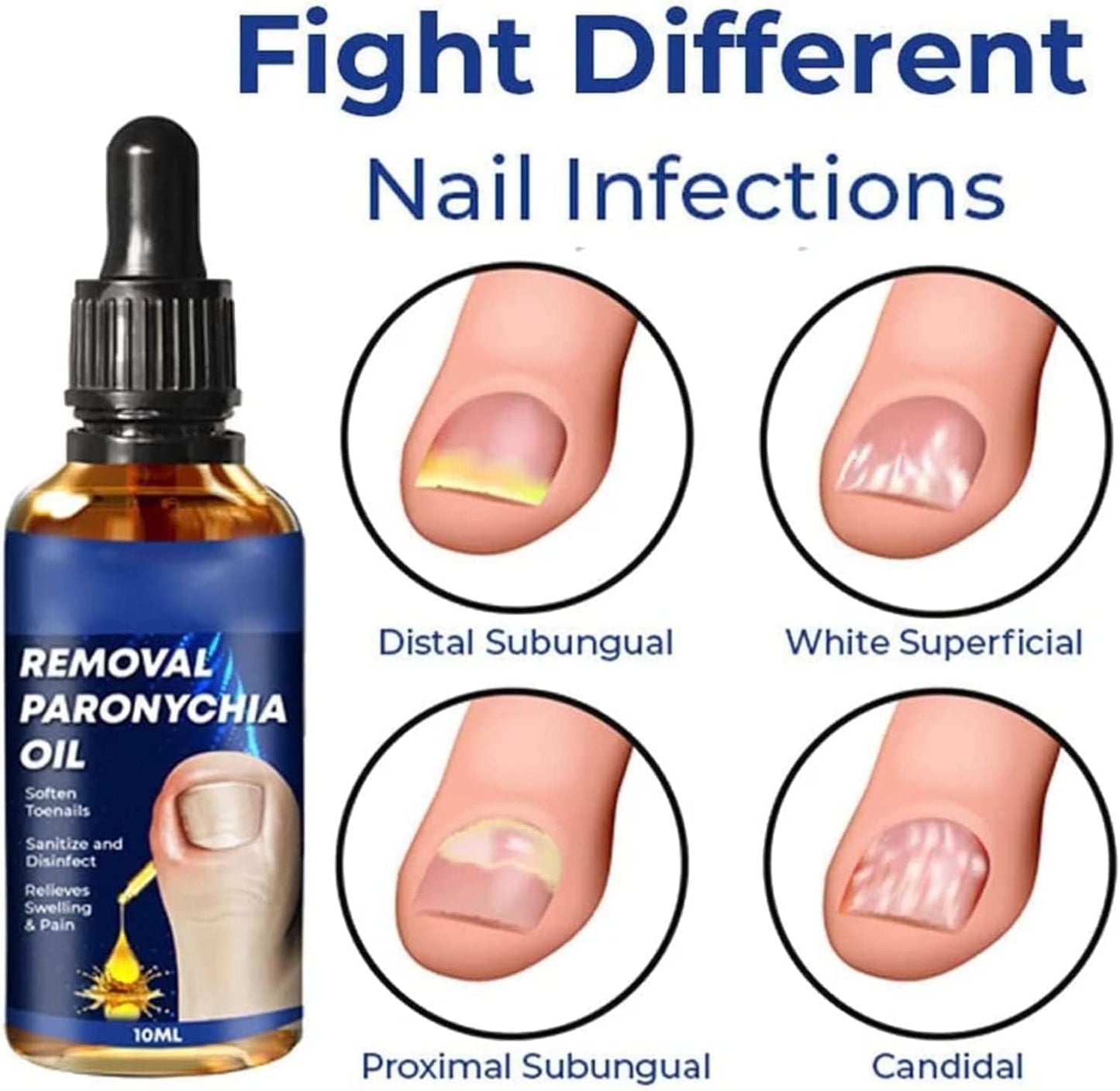 German Toenailcare Removal Paronychia Oil, Care Oil for Removing Paronychia, Toenail Treatment Best Nail Repair Solution,Nail Renewal Liquid for Damaged & Discoloration Nail (2 Pieces)