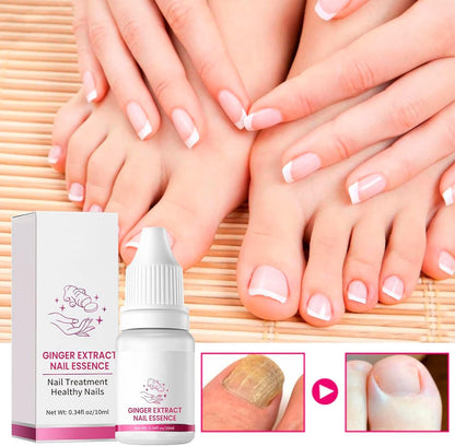 Fungigone Nail Treatment, Fungigone Nail Fungus Remover, For Toenail & Foot Care, Gentle, Fast-Absorbing Formula, Easy Daily Use (2)