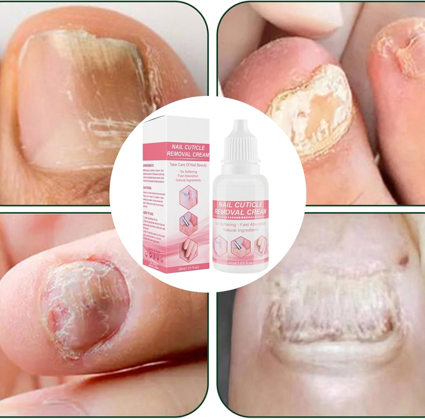 Cuticle Lotion, Cuticle Cream, Moisturizing Professional Softener Remover, Hydrating Strengthens Softens Dry Dead Skin, Nails Care Therapyfor Overgrown Moisturizer, 3.35 Inches