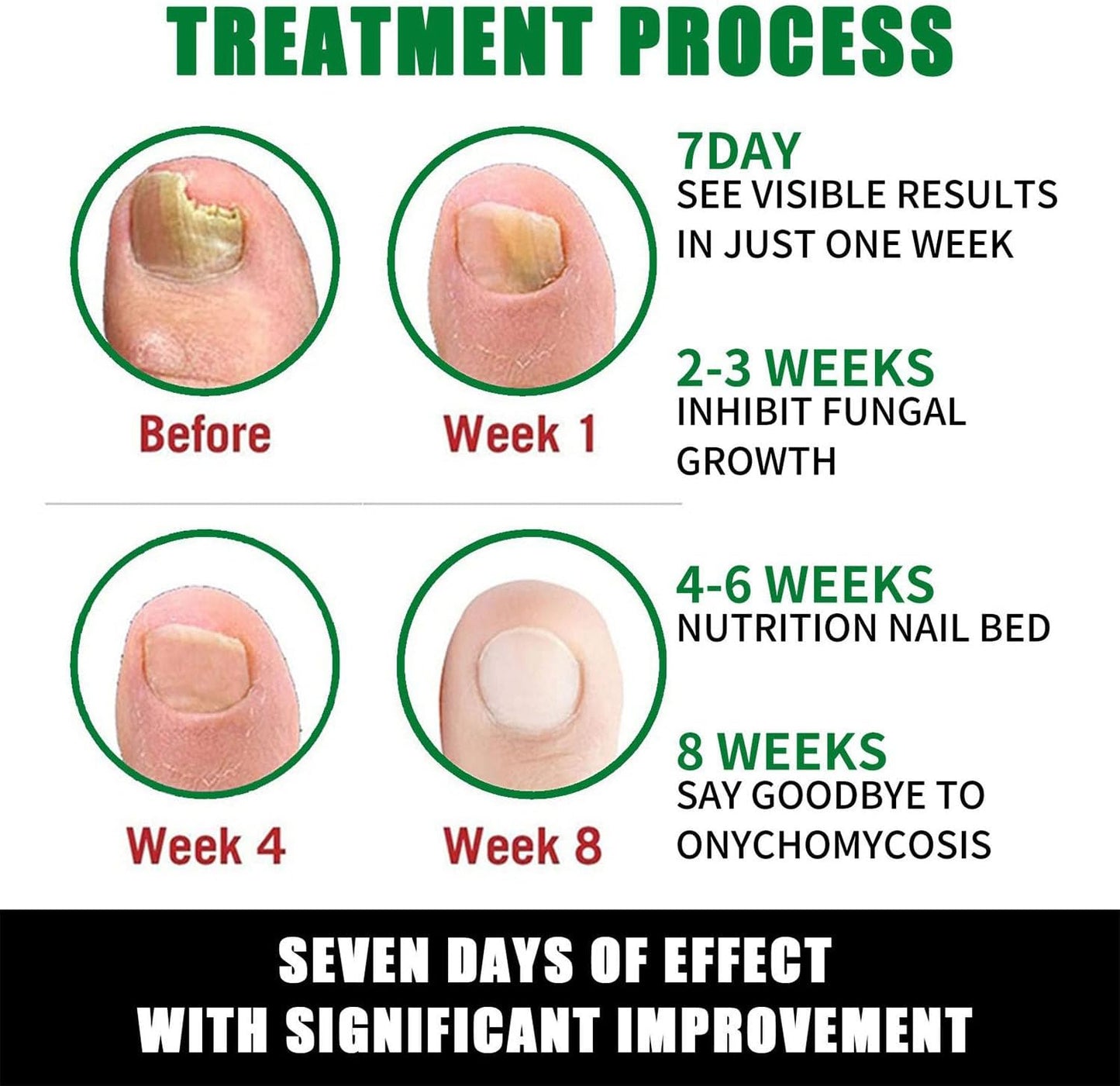 Beauras Nail Fungus Treatment, Beauras 7 Day Nail Fungus Treatment, Finger Nail Growth Serum, Ginger Cuticle Care Oil For Nails, Repair And Strengthen, Damaged, Broken, Restoring Healthy Nails (2pcs)