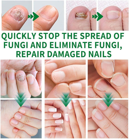 Mimoqk Organic Nail Growth Oil, 60 ml Portatile Strengthener, Professional Cuticle Care Solution, Toenail Repair Liquid, Repairing and Thickening Formula for Healthy Nails