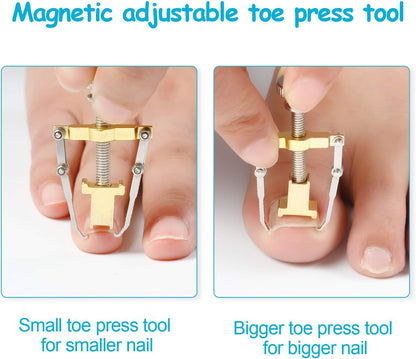2 Pieces Ingrown Toenail Tool Ingrown Toenail Tool Stainless Steel Toe Cap Foot Care Tool for Paronychia (Gold)