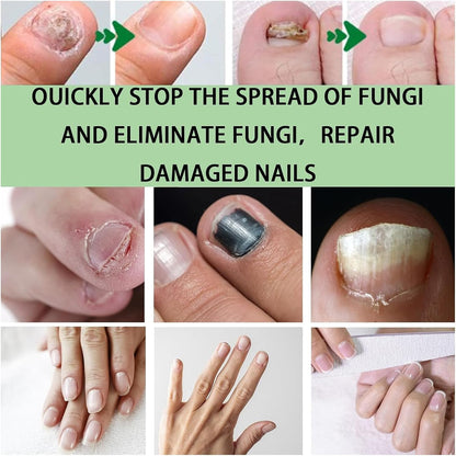Ginger Growth Care Serum，Helps Nails Healthy Grow (2pcs)