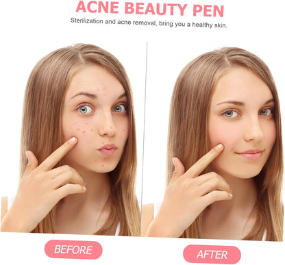 minkissy Led Face Care Pen Treatment Device for Skincare Products Safe Professional Beauty Care