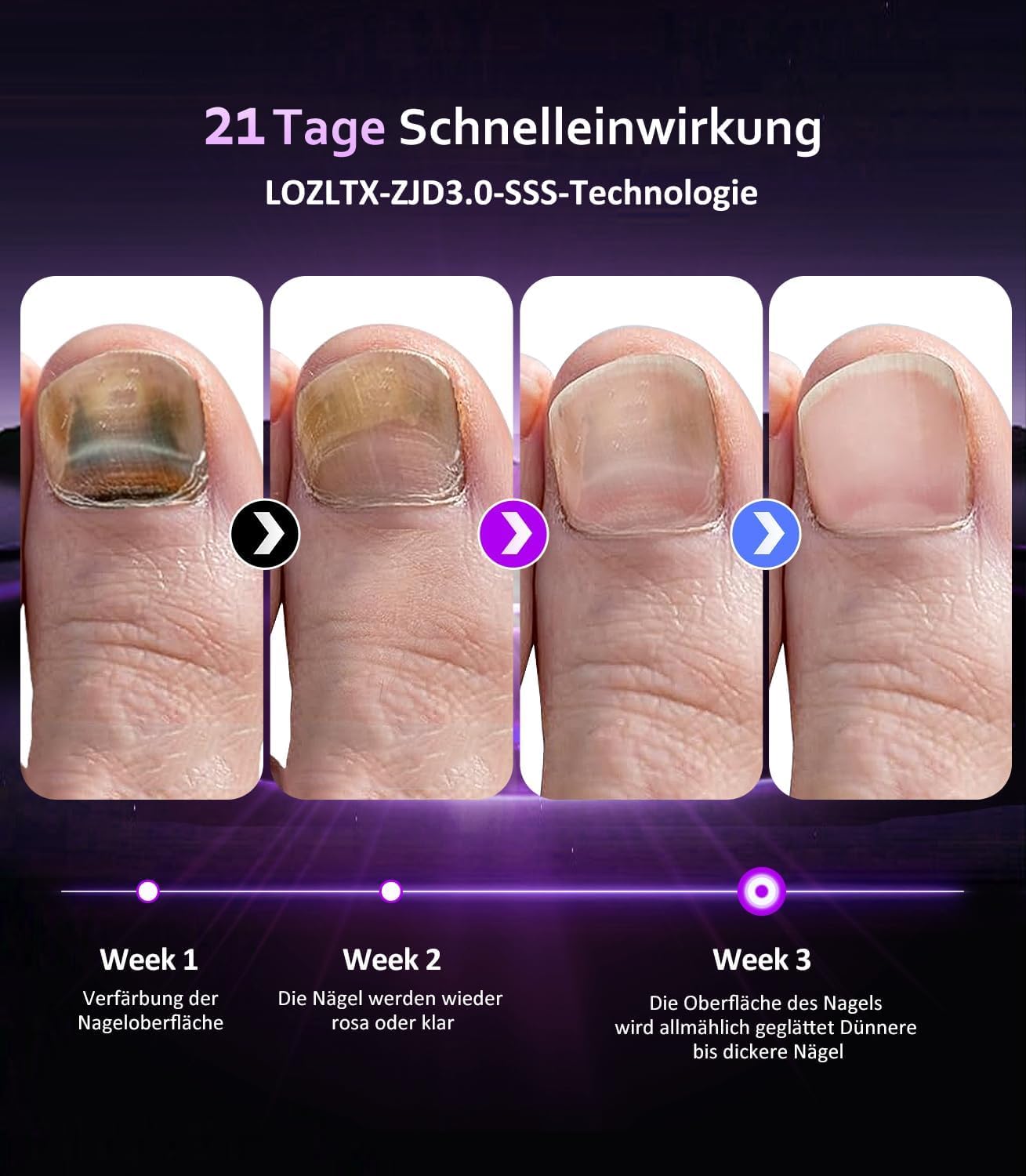 LOZLTX 4.0 Quality Nail Mushroom Laser & Stopwatch & Fruity Nail Care Pen【Stronger Fast Acting Therapy】Nail Mushroom Laser Device 【SGS Approved Safe and Reliable】Improved