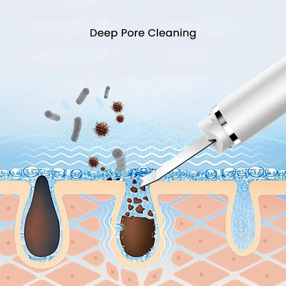 AIWOIT Scrubber for Skin Care Blackhead Remover Face Spatula Black Head Removal Pore Cleaner Tools for Facial Deep Cleansing