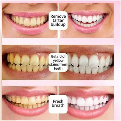 SP-6 Ultra Whitening Toothpaste, Sp 6 Toothpaste, Toothpaste Sp-6 Brightening, Probiotics Brightening Toothpaste, Deep Cleaning Oral Care Toothpaste 120g