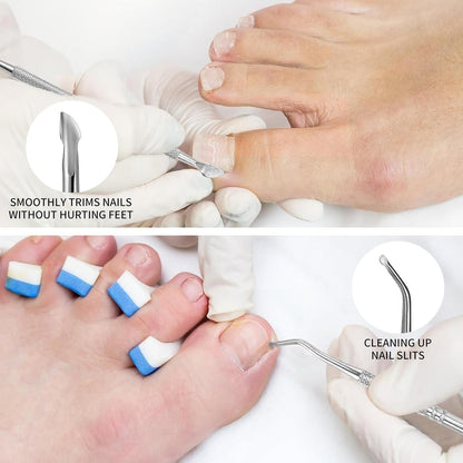 Oiieco 114 PCS Ingrown Toenail Treatment Kit with Corrector Strips,Nail Clippers & Tools,Professional Pain Relief for Ingrowing Toenails