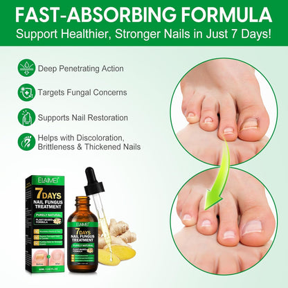 7 Day Nail Fungus Treatment | Natural Plant-Based Nail Repair Oil with Ginger Extract | Strengthens & Nourishes Nails & Cuticles | Repairs Discolouration & Brittleness | Suitable for Hands & Feet | 60mL