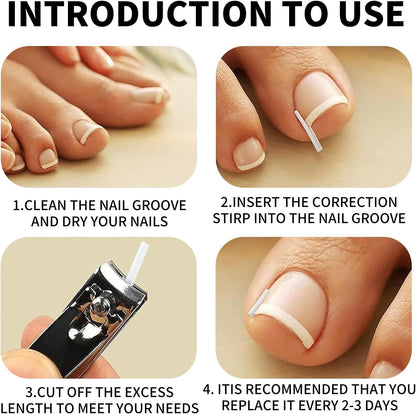 Oiieco 114 PCS Ingrown Toenail Treatment Kit with Corrector Strips,Nail Clippers & Tools,Professional Pain Relief for Ingrowing Toenails