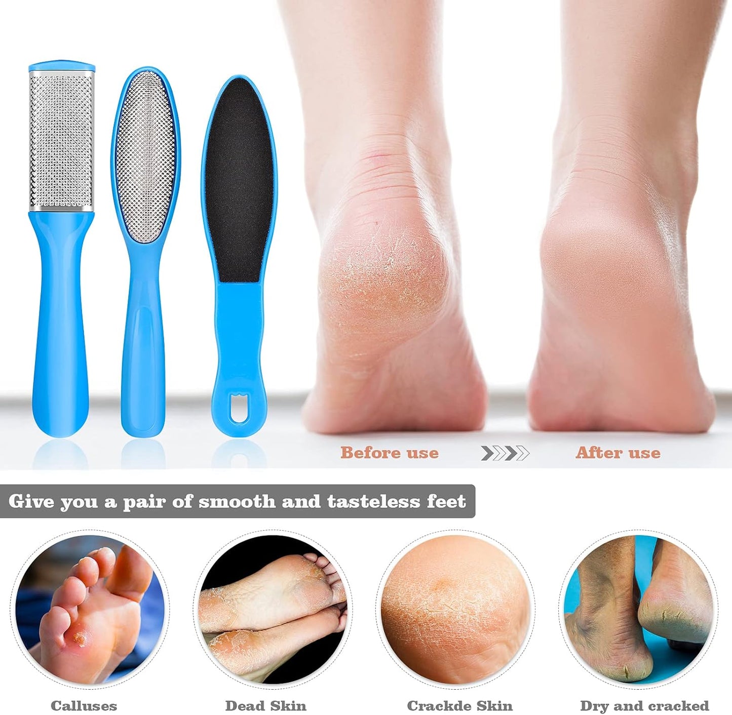 Manicure & Pedicure Kits - 23 in 1 Professional Pedicure Tools Stainless Steel Foot Care and Nail Tools Set, Foot File Foot Rasp Dead Skin Callus Remover Kit for Women Men Home Foot Care, Blue