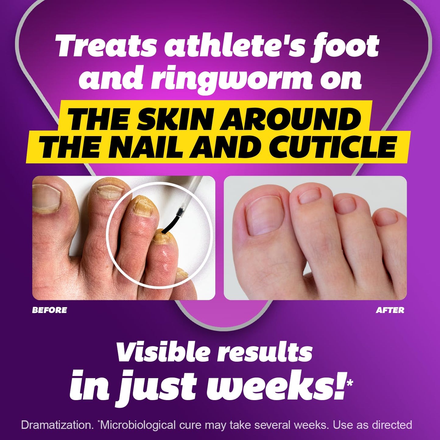 SILKA Max Strength Antifungal Liquid for Toenail Health with Brush Applicator, Results in 1 Week, Nail Fungus Treatment for Damaged Toenails, Athlete's Foot Treatment, Tolnaftate 1% 0.45 Fl Oz
