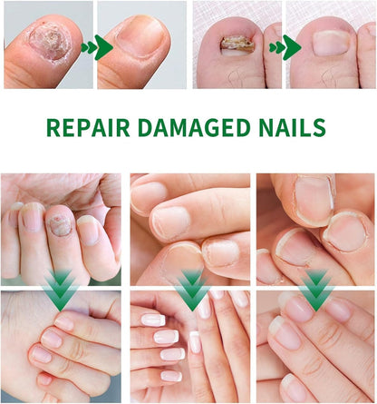 Ginger Nail Treatment Nail Support Nail Care, Nail Treatment Serum, Ginger Nail Growth Serum, Nourishing Strengthening Nail Oil (3pcs)