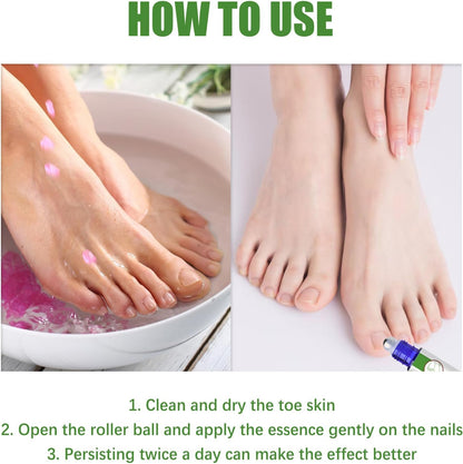 Iouyjiu Nail Strengthener Toenail Care Repair Cracked Nail Hydrating Formula Organic Ingredients 1 Stick Ideal for Fast and Effective Reliefs Home Use 10ml