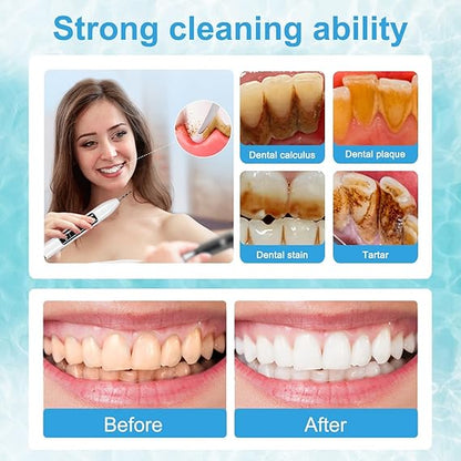 Plaque Tartar Remover for Teeth