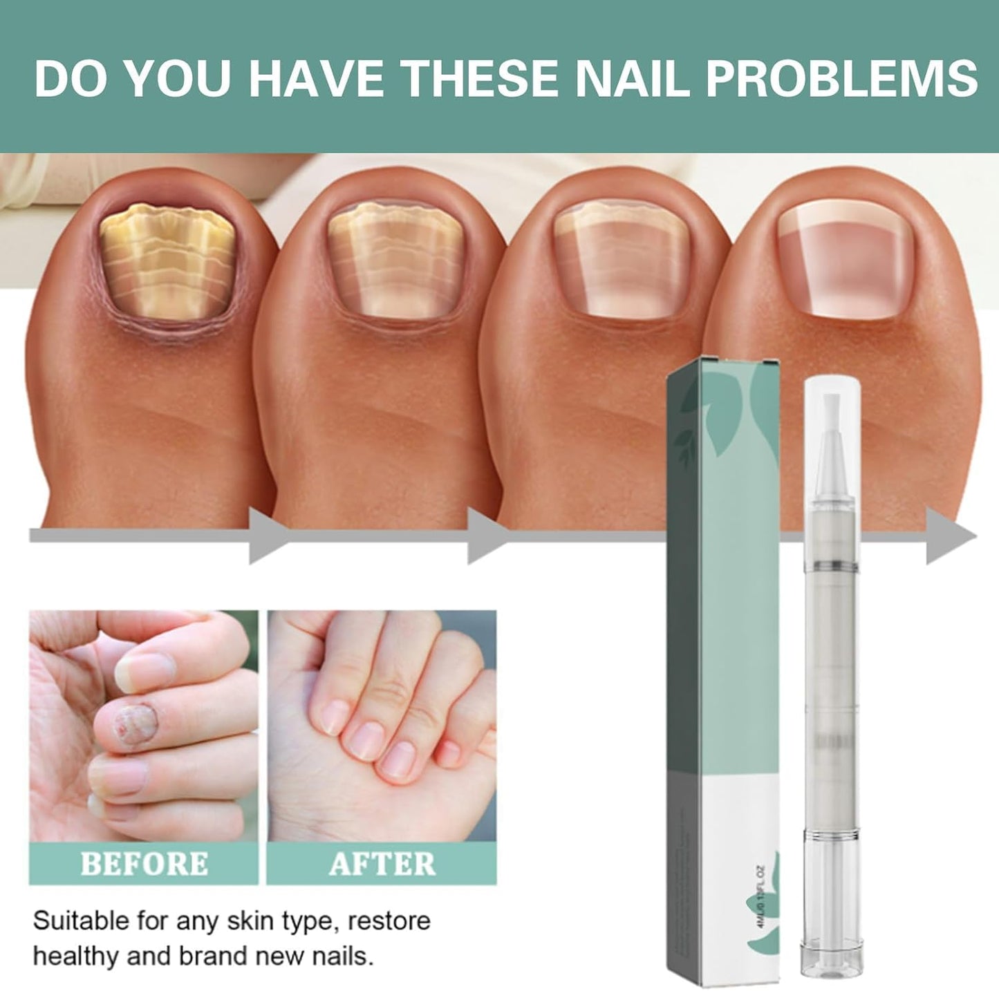 4 Pieces Nail Care Oil Pen, Nail Care Oil Pen Nourishing, Nail Moisturizer Oil, Deeply Moisturizes and Nourishes