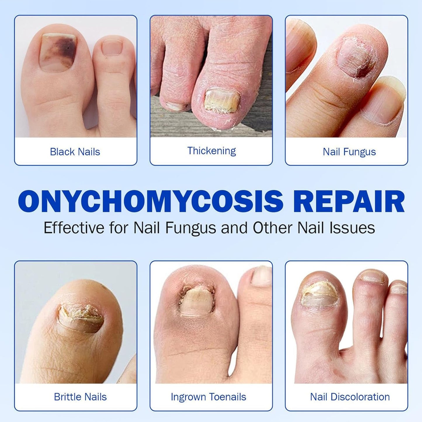 Toenail Patches, Nighttime Nail Repair, Breathable Foot Care, Crack and Discoloration Medication, Comfortable Adhesive, Pedicure Solution for Men Women Athletes Home Use