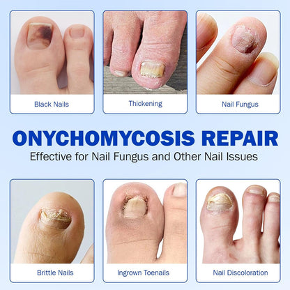 Toenail Patches, Nighttime Nail Repair, Breathable Foot Care, Crack and Discoloration Medication, Comfortable Adhesive, Pedicure Solution for Men Women Athletes Home Use