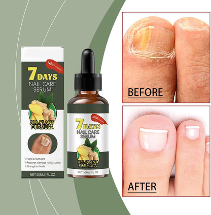 Nail Care Products, Moisturizer Growth Corrector, Quick Absorb and Effective Nail Formula, Professional Quality, Ideal for Women, Seniors, Home Use, Salon, Travel, 30ml