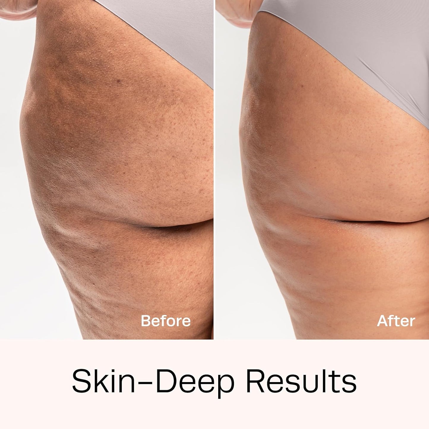 Hot Vita Retinol Body Toner – Nighttime Anti-Aging & Anti-Cellulite Formula with Natural, Skin-Safe Ingredients to Tighten Skin, Smooth Complexion & Enhance Radiance