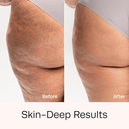 Hot Vita Retinol Body Toner – Nighttime Anti-Aging & Anti-Cellulite Formula with Natural, Skin-Safe Ingredients to Tighten Skin, Smooth Complexion & Enhance Radiance