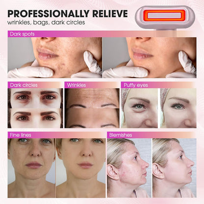 Dermal-Tech Advance 360 4-in-1 Facial Skincare Wand | Red Light Therapy for Face and Neck | Face Massager & Microcurrent Facial Device | Rose Gold