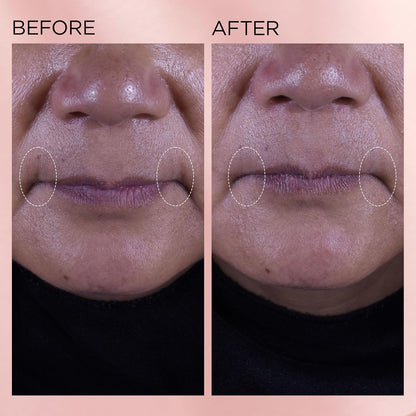 Elizabeth Arden Retinol Serum Wrinkle Filler + HPR Next Generation Retinoid, Ceramide, and Peptide Rapid Skin Renewing Water Day and Night Cream for Face and Neck