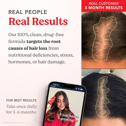 HAIRtamin Fast Hair Growth Biotin Vitamins Gluten Free thirty Vegetarian Capsules Supports Stronger Longer Thicker Hair Reduces Hair Loss and Thinning All Natural Supplement three pack