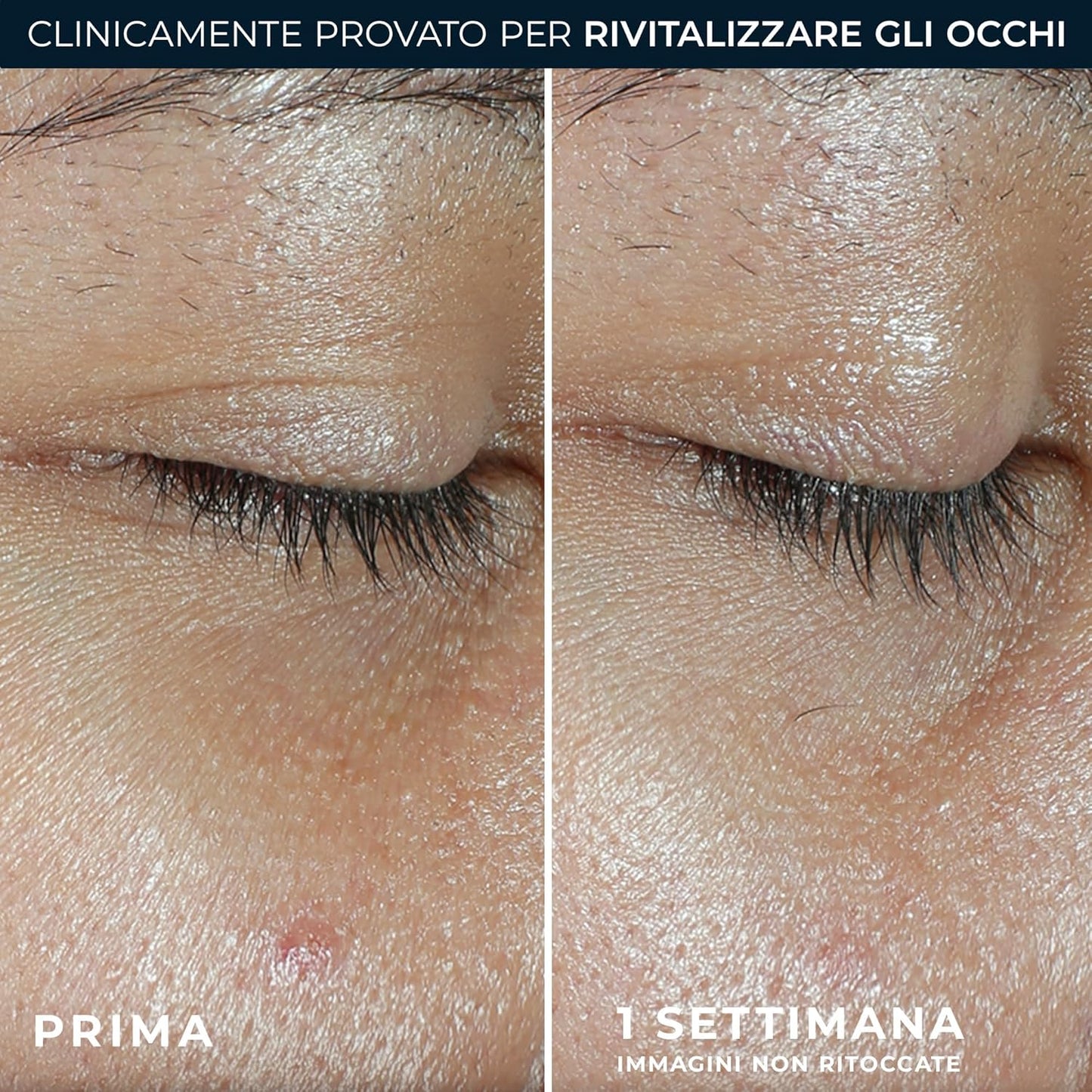 RoC - Multi Correxion Revive + Glow Eye Balm - Vitamin C Formula And Peptides - Reduction Of Dark Cracks And Bags - Contactless Application - Hypoallergenic - 4g