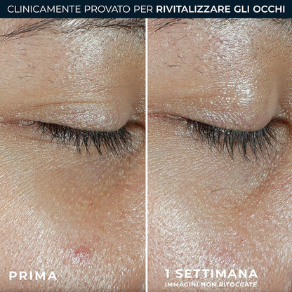 RoC - Multi Correxion Revive + Glow Eye Balm - Vitamin C Formula And Peptides - Reduction Of Dark Cracks And Bags - Contactless Application - Hypoallergenic - 4g