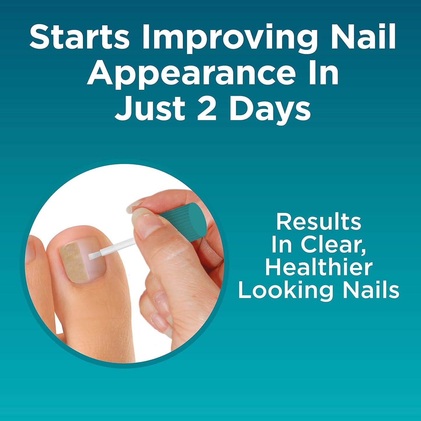Opti-Nail 2-in-1 Fungal Nail Repair Plus Antifungal, Improves Nail Appearance and Kills Fungus Around Nail.