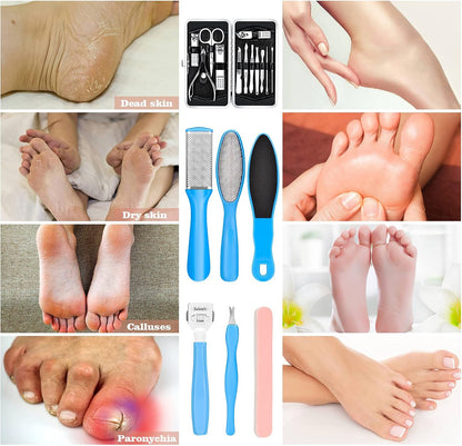 Manicure & Pedicure Kits - 23 in 1 Professional Pedicure Tools Stainless Steel Foot Care and Nail Tools Set, Foot File Foot Rasp Dead Skin Callus Remover Kit for Women Men Home Foot Care, Blue