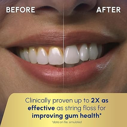 Waterpik Aquarius Water Flosser For Teeth Cleaning, Gums, Braces, Dental Care, Electric Power With 10 Settings, 7 Tips For Multiple Users And Needs, ADA Accepted, Black WP-662, Packaging May Vary