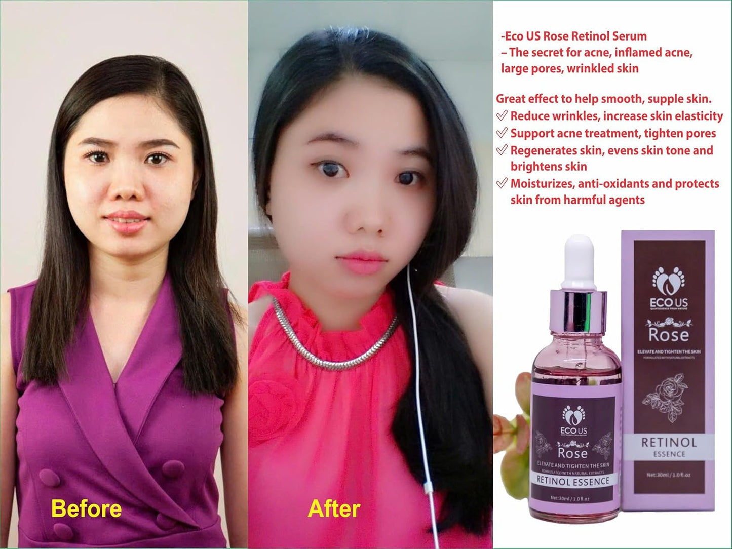Rose Retinol Lifting Serum - Anti-Aging Serum with Retinol for more Smooth