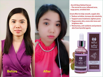 Rose Retinol Lifting Serum - Anti-Aging Serum with Retinol for more Smooth