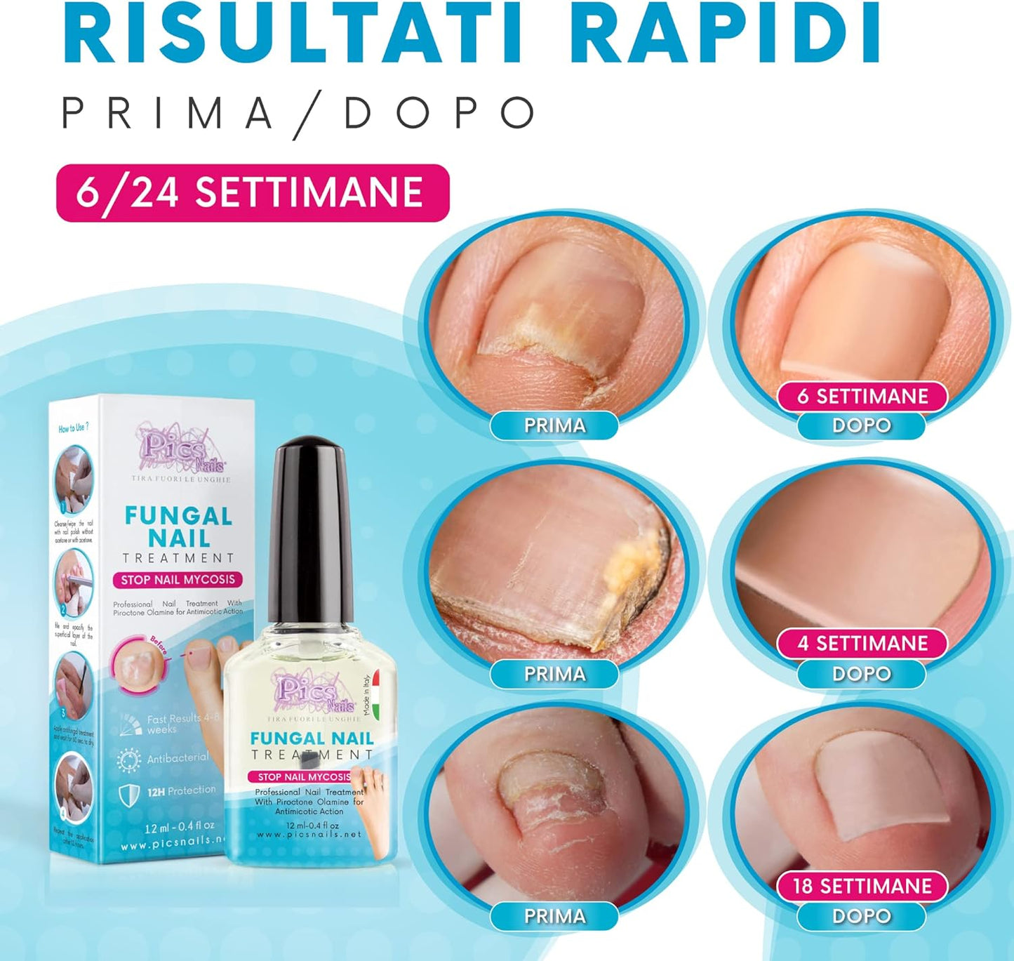 Antifungal Nail Feet and Hands 12 ml – Treatment Prevents Mycosis/Fungi and Restores the Natural Appearance of the Nail.