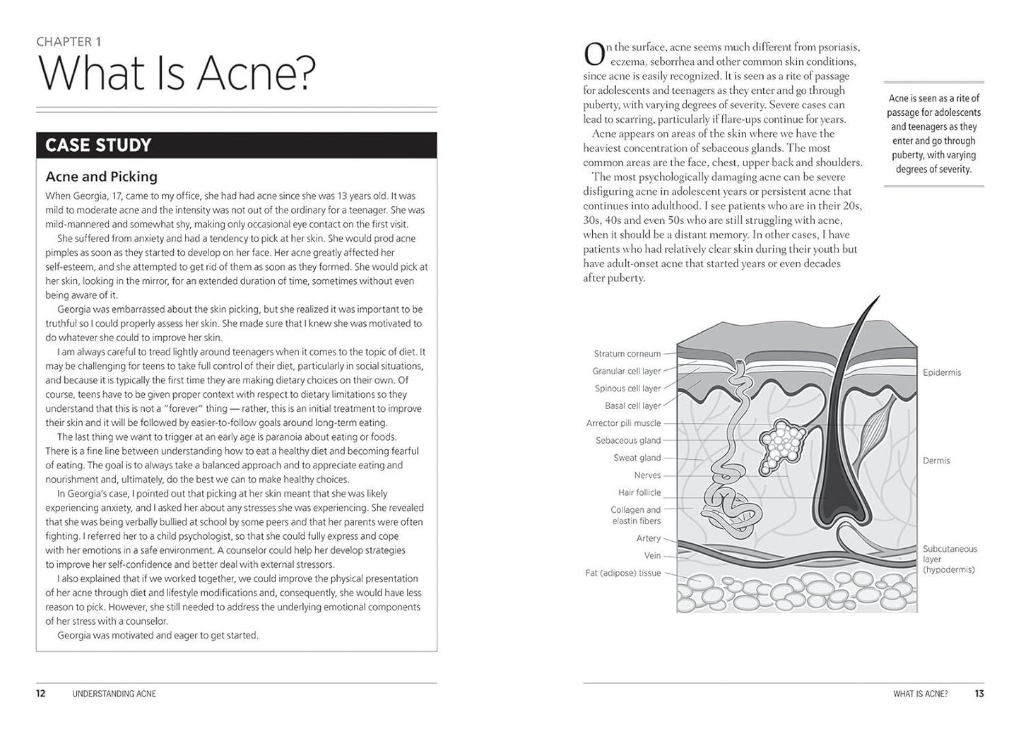 The Complete Acne Health and Diet Guide: Naturally Clear Skin Without Antibiotics