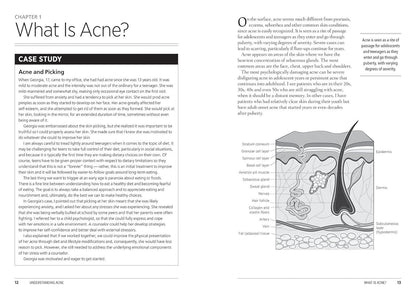 The Complete Acne Health and Diet Guide: Naturally Clear Skin Without Antibiotics