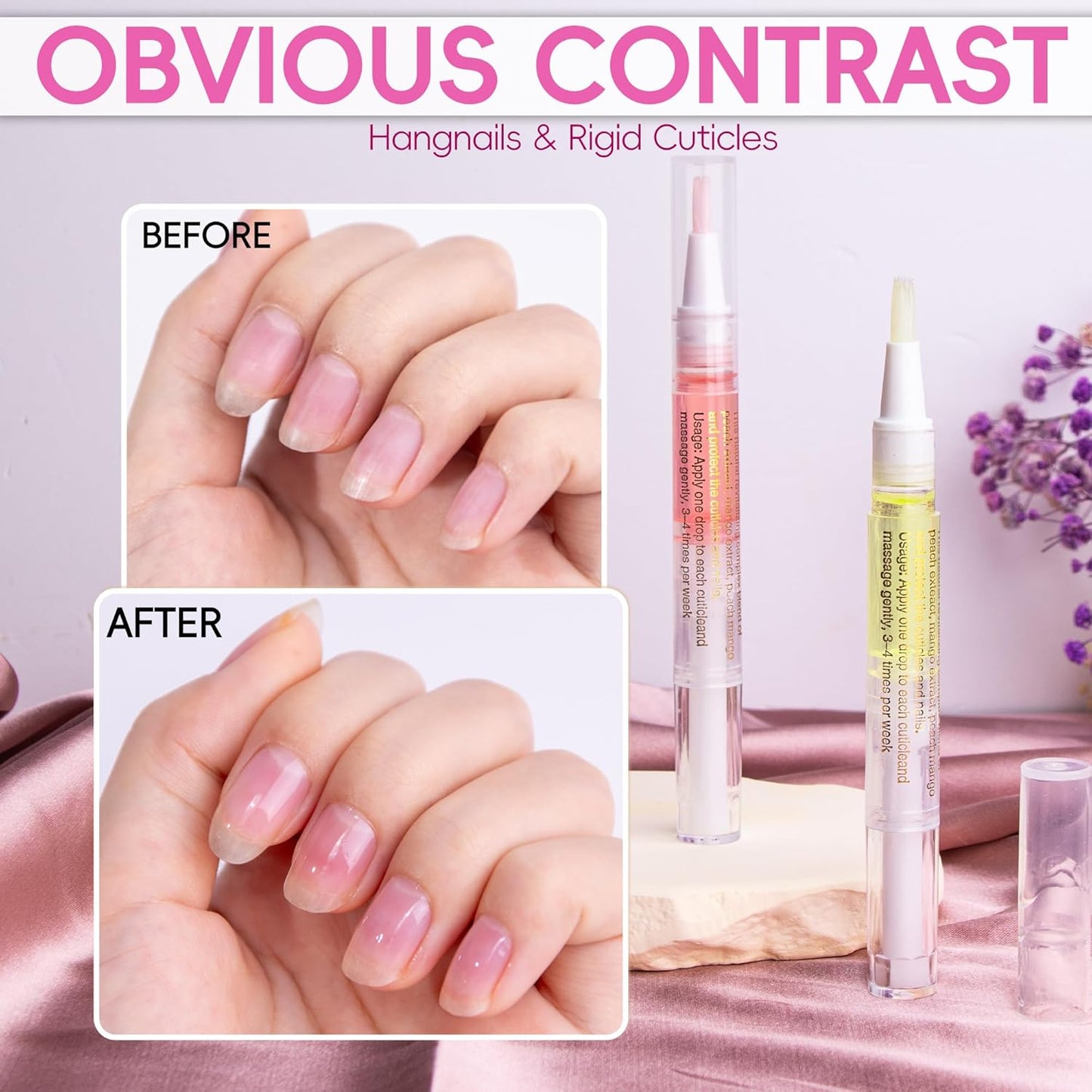 2PCS Cuticle Oil Pen for Nails,Nail Oil Pen for Nail Care,Cuticle Oil for Nails with Nail File,Nail Oil Cuticle Prevent Dry Cracking and Hangnails,Deep Nourishment(Pineapple & Peach Flavor)