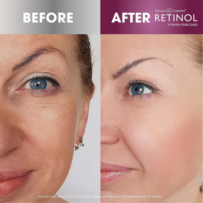 Retinol Anti-Aging Cleansing Towelettes – All-in-One Cleanser, Toner & Makeup Remover in a Convenient Pre-Moistened Wipe – On-The-Go Exfoliating, Toning & Hydrating Leaves Skin Clean, Fresh & Refined