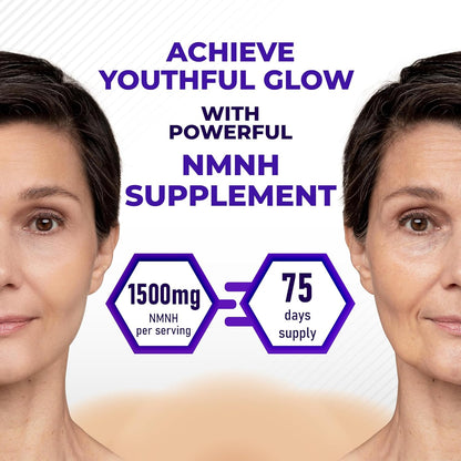 High Potency NMNH with Resveratrol, Quercetin, Green Tea, Milk Thistle, Turmeric & Rhodiola Rosea – Supports Cellular Wellness & Anti-Aging* – Made in The USA