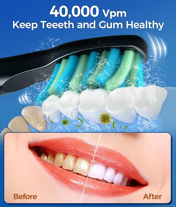 Sonic Electric Toothbrushes for Adults and Kids, 8 Brush Heads Electric Toothbrush with 40000 VPM Deep Clean 5 Modes, Rechargeable Fast Charge 4 Hours Last 30 Days