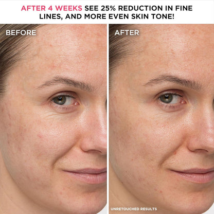 iT COSMETICS, Anti-Aging Moisturising Cream, For All Skin Types, Formula With Niacinamide, Confidence In A Cream Supercharged, 60ml