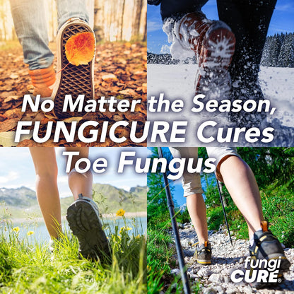 UNGICURE Intensive Spray, Antifungal Treatment, Kills 6 Types of Fungus, Soothes Itching & Burning, 2 Fl Oz (Pack of 1)